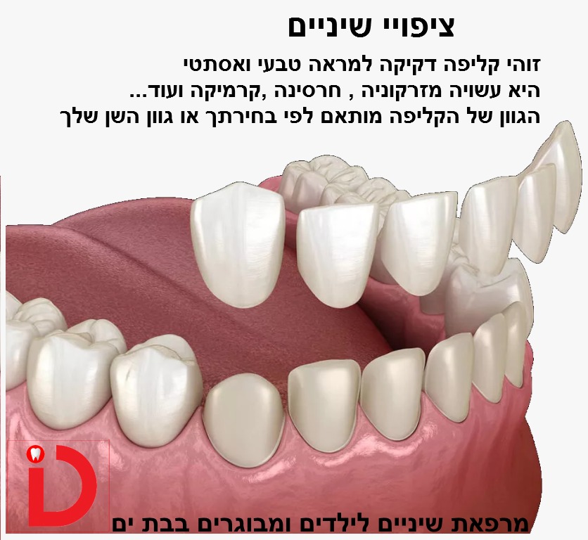 שתלים מרפאת השיניים בבת ים