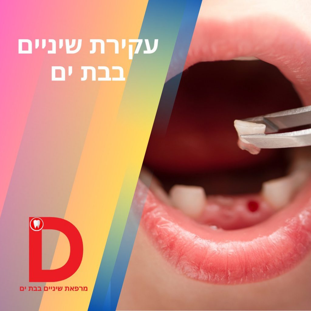 מרפאת השיניים המובילה בבת ים והאזור